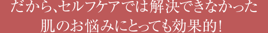 だから、セルフケアでは解決できなかった肌のお悩みにとっても効果的！