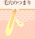 毛穴のつまり